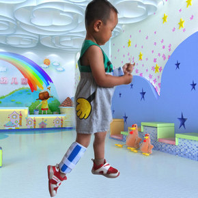 儿童外固定支具胫腓骨折夹板小腿固定护具钢板矫形固定支具
