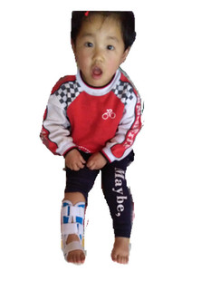 幼儿儿童护踝踝关节固定支具胫腓超踝护具骨折伤韧带松脱固定护具